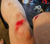 rash.jpg