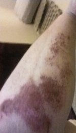 graze arm.JPG
