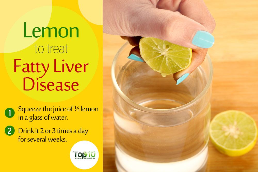 Fatty-Liver-Disease-lemon-water.jpg