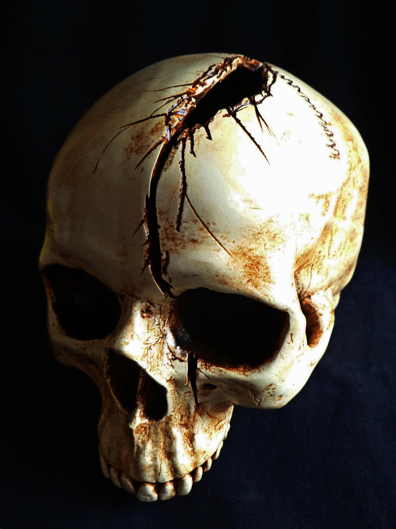 skull_with_axe_wound_by_skullsdirect-d4pxgg5.jpg