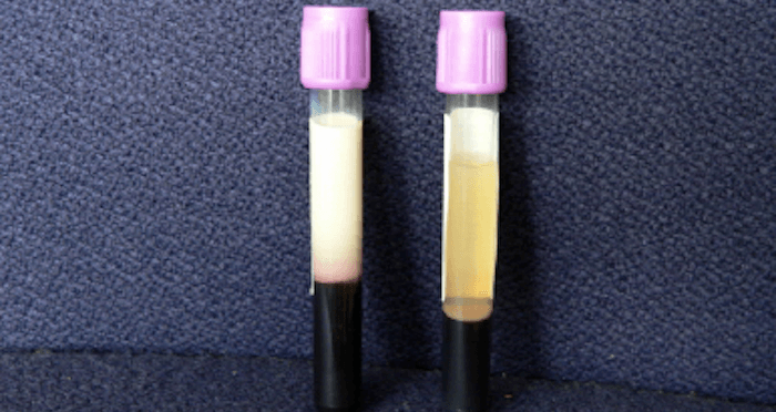 two-milky-blood-vials.png