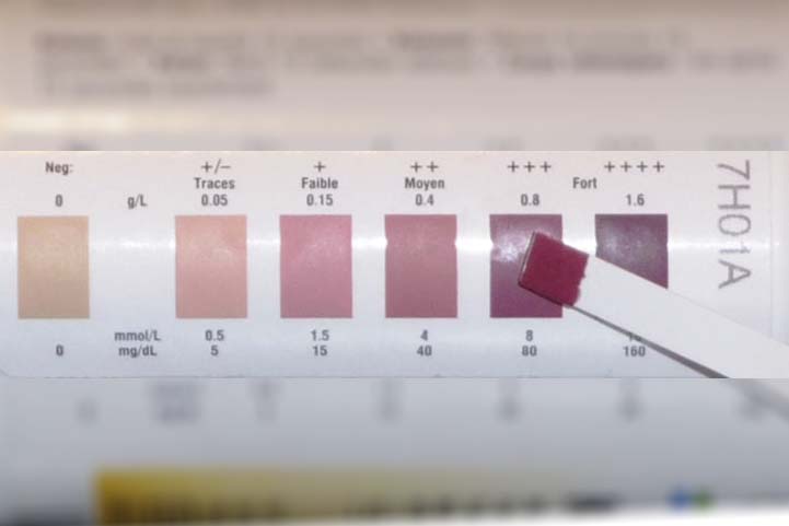 measuring-ketosis-with-ketone-strips-.jpg